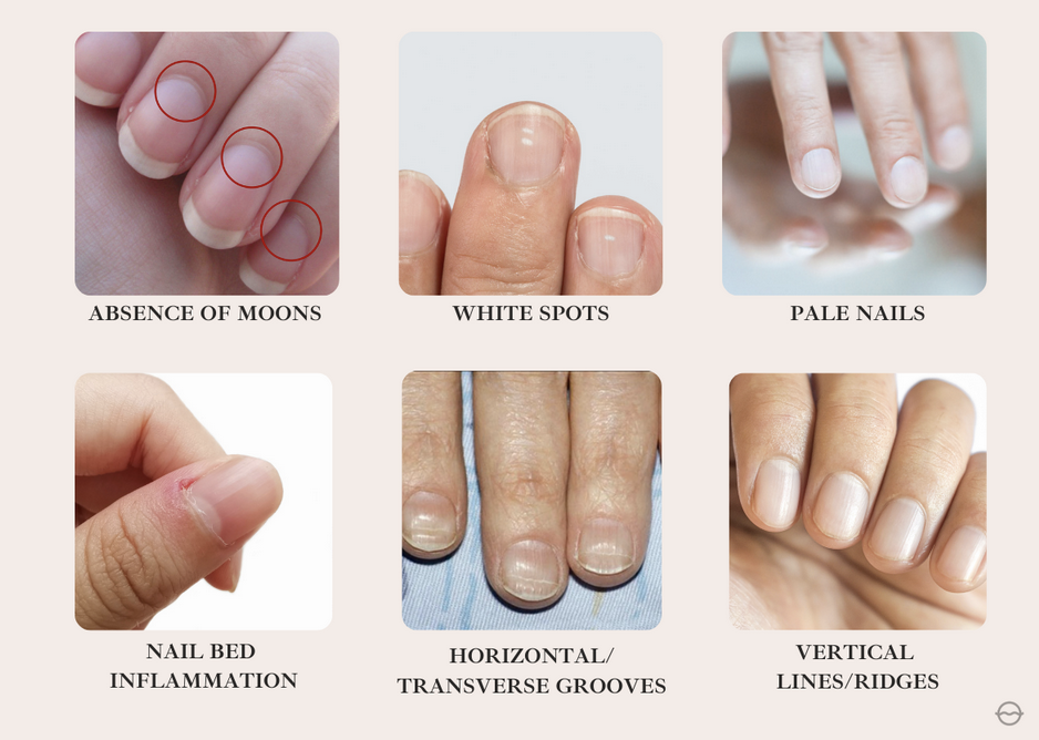 6 Signs Your Fingernails Are Trying To Tell You Something - Organic 